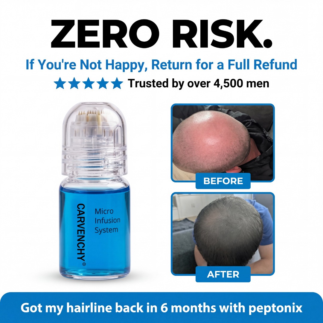 Ingrown Hair Serum - 育毛マイクロニードリングGHK-Cuセラム（ブルーカッパーペプチド配合）頭皮マイクロニードリング用セラム