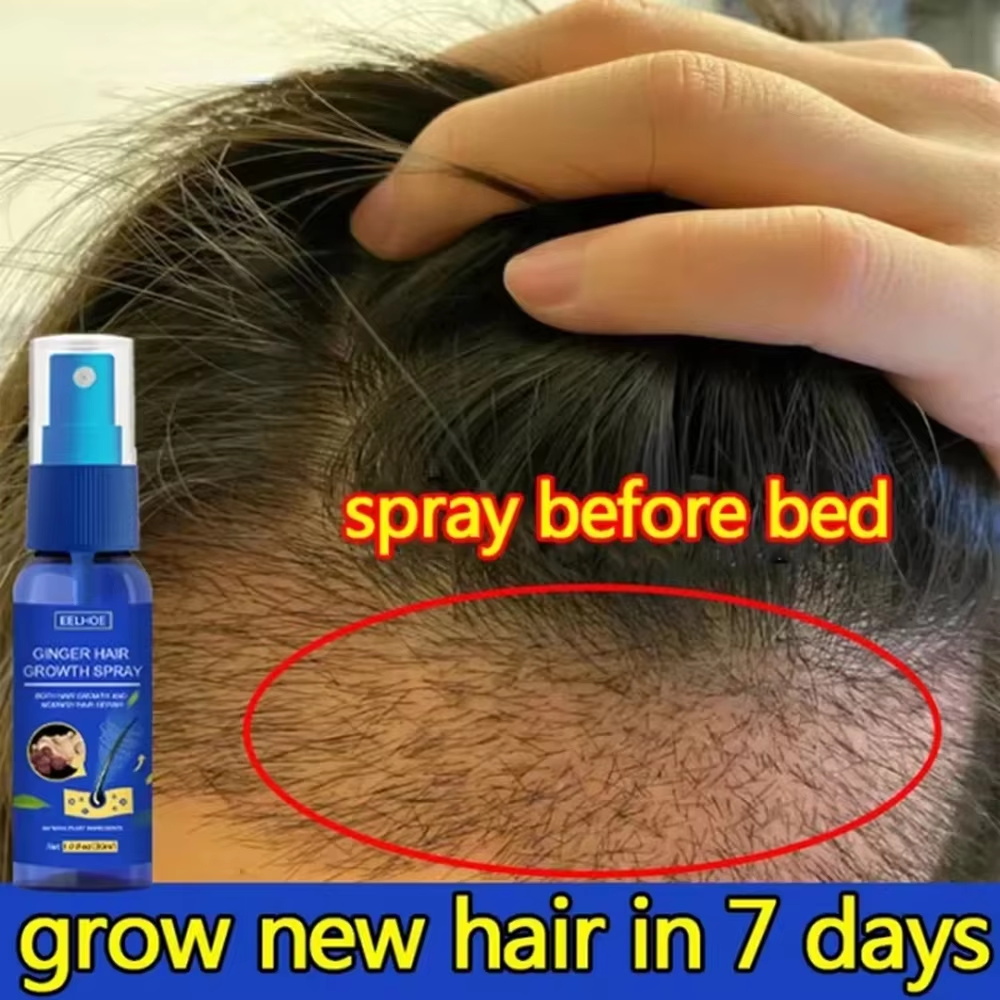 Ingrown Hair Serum - 速効性ジンジャーヘアグローススプレー、毛根育成、脱毛防止、育毛セラム、頭皮ダメージ修復、栄養ケア製品、女性男性用