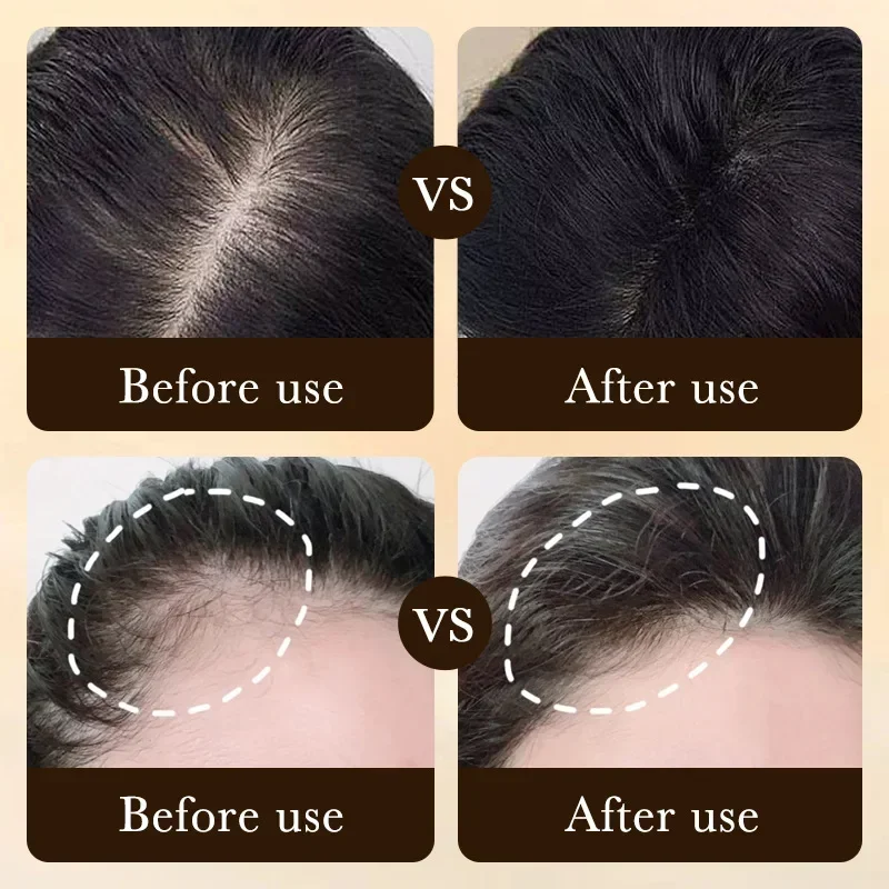 ビオチン配合育毛オイル製品、頭皮マッサージトリートメント、脱 - Ingrown Hair Serum のレビューと価格