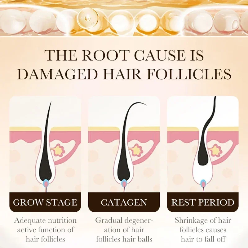 ビオチン配合育毛オイル製品、頭皮マッサージトリートメント、脱 - Ingrown Hair Serum のレビューと価格