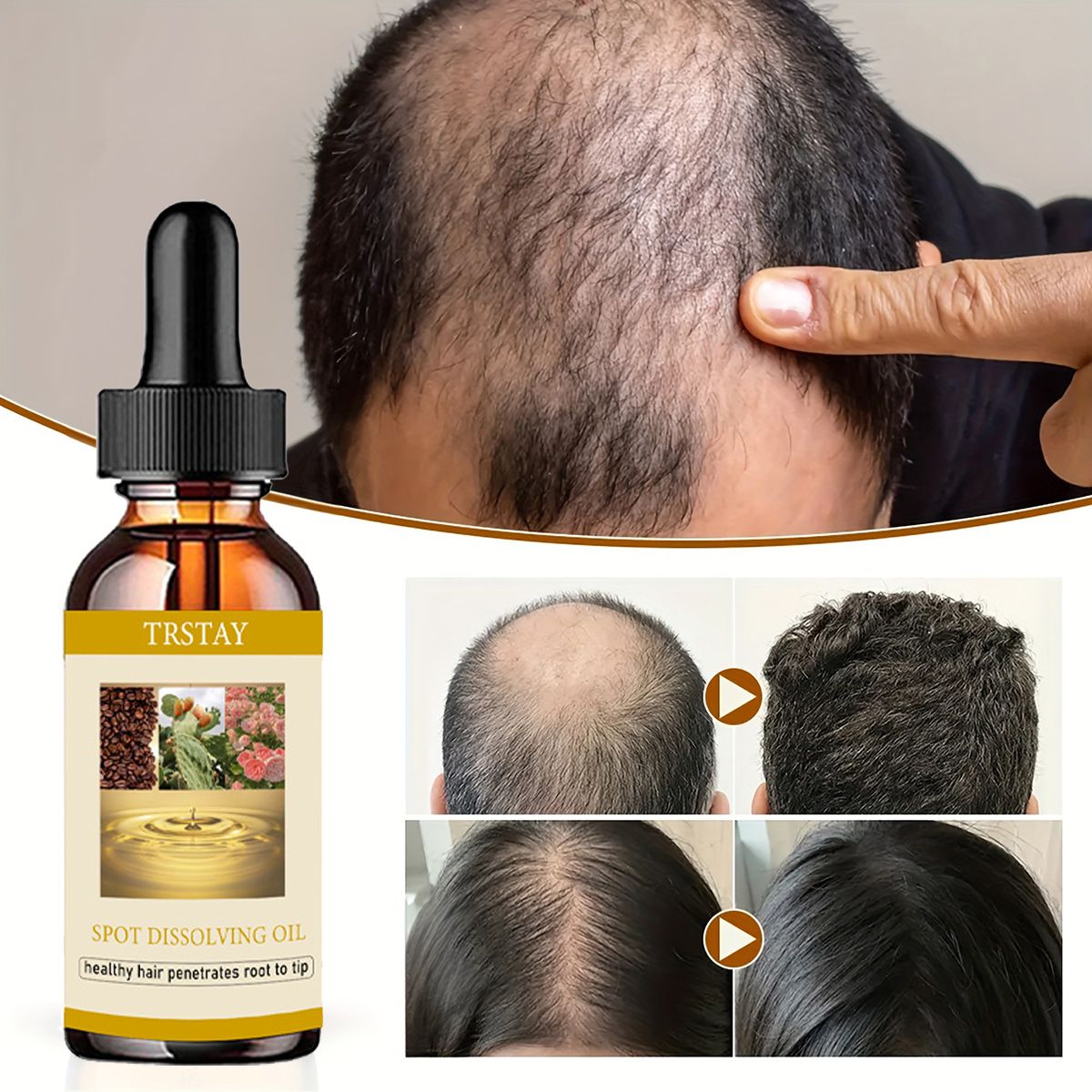 男性と女性のためのあごひげエッセンシャルオイル,ヘアケア製品 - Beard Oil Growth のレビューと価格