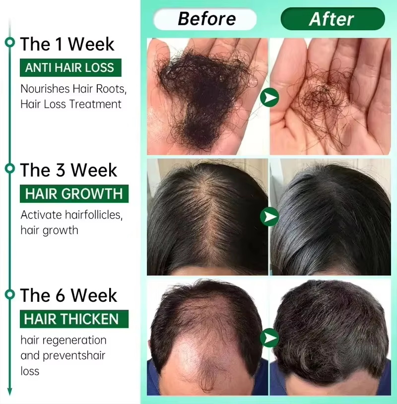 育毛血清 7 日間高速再生エッセンシャルカプセル抗脱毛ハゲ修 - Ingrown Hair Serum のレビューと価格