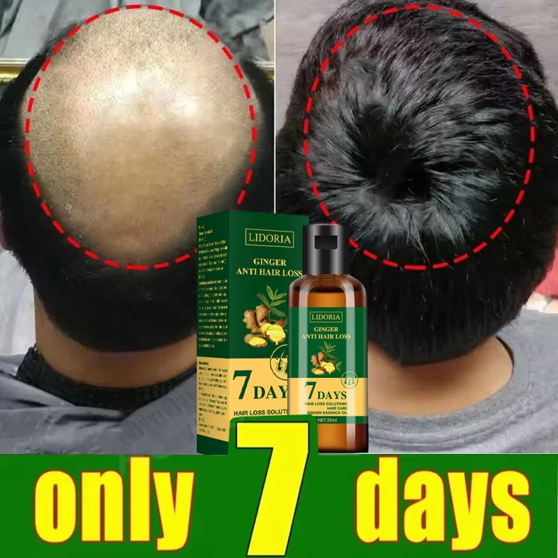 育毛血清 7 日間高速再生エッセンシャルカプセル抗脱毛ハゲ修 - Ingrown Hair Serum のレビューと価格