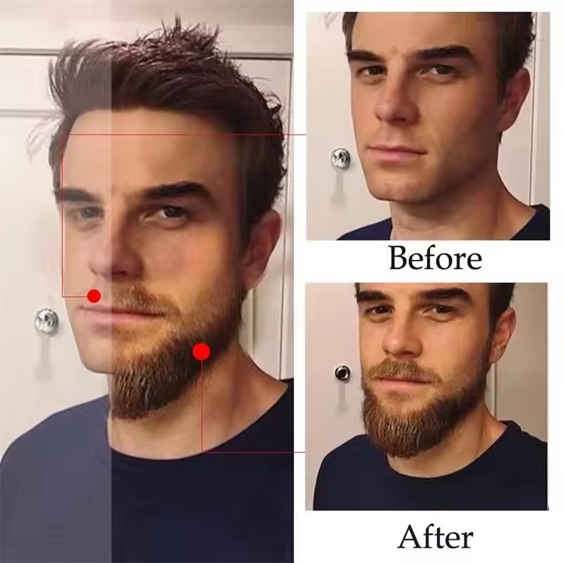 速効性のある自然な成熟男性用髭成長エッセンスオイル、毛髪の成 - Ingrown Hair Serum のレビューと価格